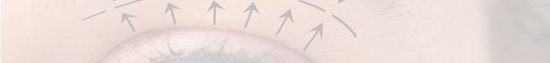 top banner